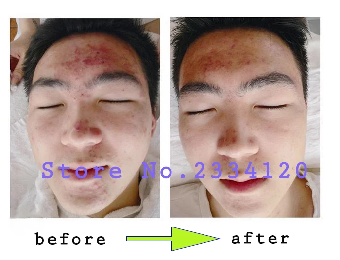 bioaqua before and after