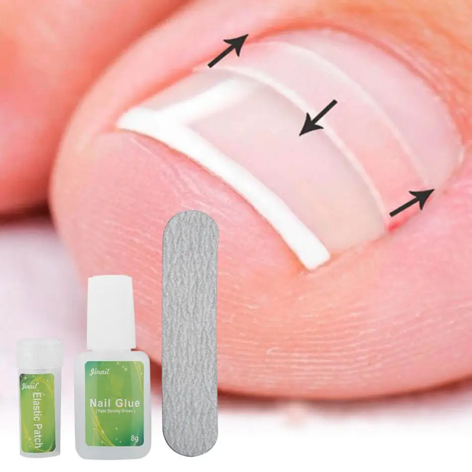 Buy 12pcs /bottle Ingrown Toenail Correction Tool Set