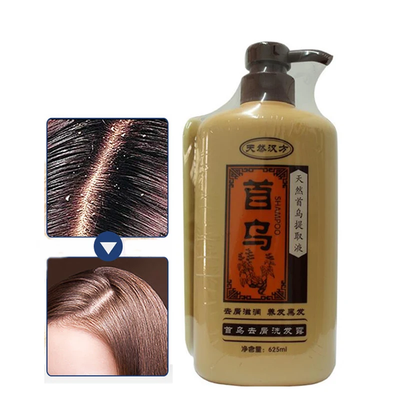 Professional Natural Chinese Medicine Extract Hair Shampoo