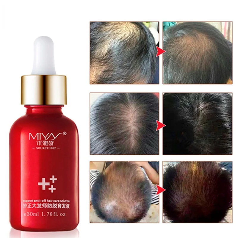 Hair Oil Hair Care Fast Powerful Hair Growth Products Regrowth Essence