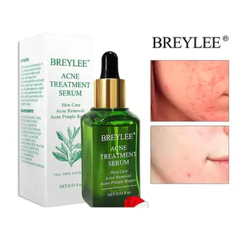 

BREYLEE Acne Treatment Serum Facial Essence Anti Acne Scar Removal Cream Face Skin Care Whitening Repair Pimple Remover For Acne