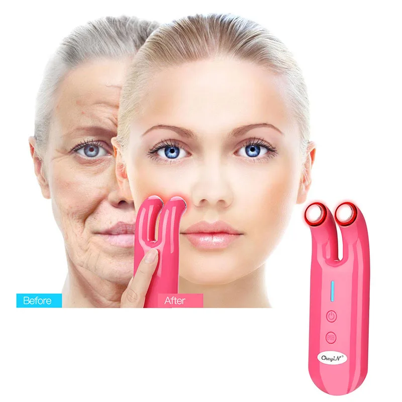 Electronic RF Massager Eye Wrinkle Removing Pen Vibration Massage Micro