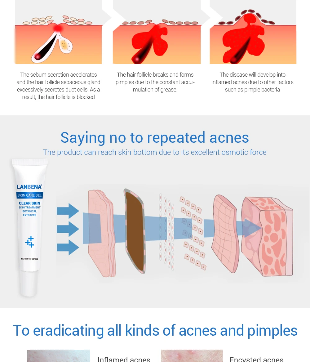 HTB1IdkFmdbJ8KJjy1zjq6yqapXaJ