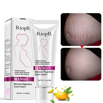 

RtopR Mango Stretch Mark Cream Natural Mild Non-irritating For Remove Pregnancy Scars Acne Cream Repair Anti-Aging Anti Winkles