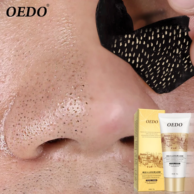 Volcanic Soil Facial Mask Acne Remove Blackhead Mite Propolis Face Care Treatment Repair Whitening Cream Skin Care Moisturizing Volcanic Soil Facial Mask Acne Remove Blackhead Mite Propolis Face Care Treatment Repair Whitening Cream Skin Care Moisturizing