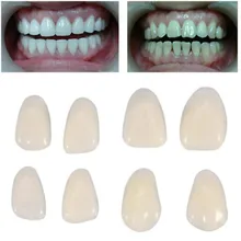 50 шт./кор. смолы для передних зубов зубные временный Корона фарфора ультра тонкий отбеливание Фанера природа стабильный зубов