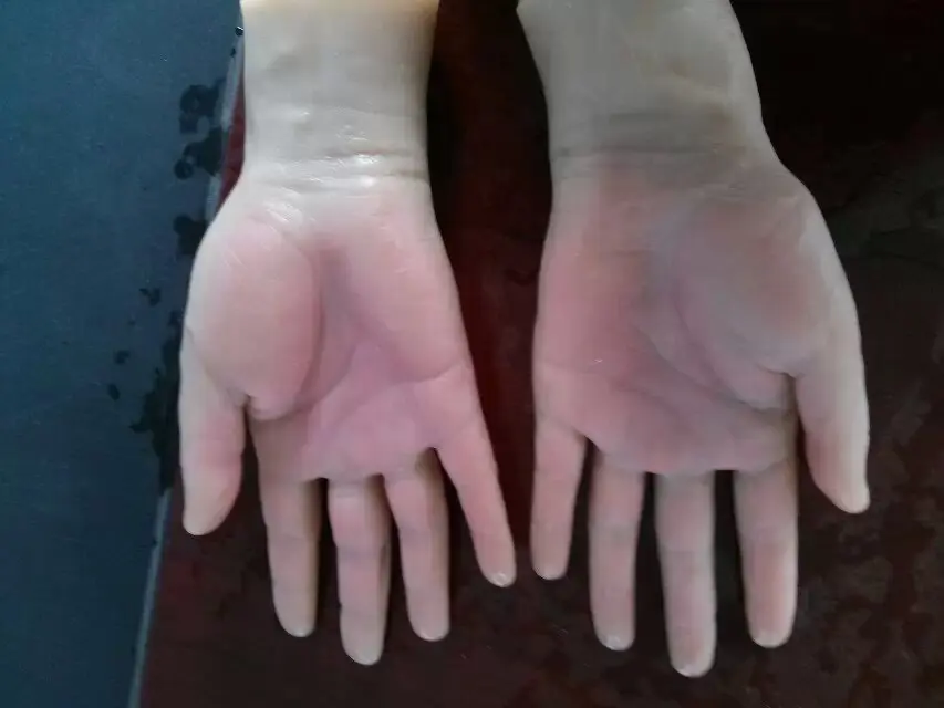 thumb