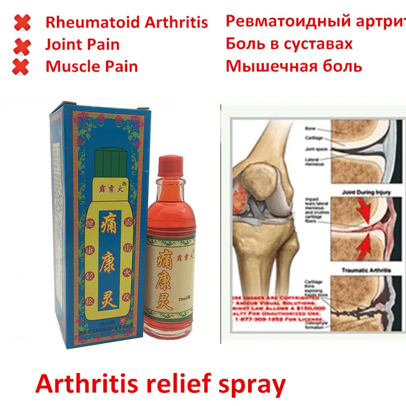 1 Pcs Chinese Herbal Medicine Joint Pain Ointment Privet.balm Liquid