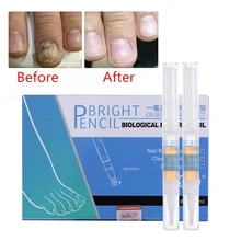 3 мл Лечение ногтей от грибка ручка ногтей Яркий карандаш решение анти Fongique инфекции противогрибковый биологический ремонт восстанавливает здоровый