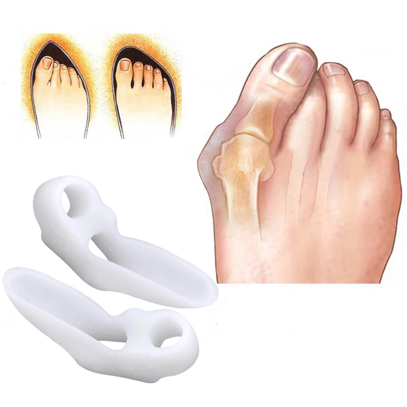 4PCS=2Pairs Toe Corrector Separator Pedicure Tools Orthopedic Bunion Corrector Hallux Valgus Toe Protector Foot Care Silicone