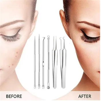 

5pcs Blackhead Remover Tool Black Spots Needles Pore Cleanser Comedone Pimple Blemish Extractor Beauty Acne Remover Tools Set