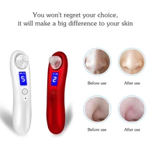 Вакуумное устройство для удаления черных точек всасывания средство против акне машины Электрический Очиститель пор Прыщ remover инструмент для очищения лица skin care инструменты