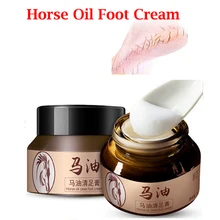 Лошадь масло для ног крем уход авитаминоза крем для спортсмена ножной зуд мозолей anti-обветривания пилинг авитаминоза плохая ноги мазь