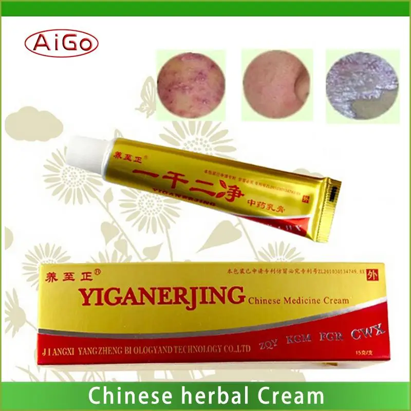 Psoriasis Cream Treatment, Genital Itching Dermatitis Eczema Ointment
