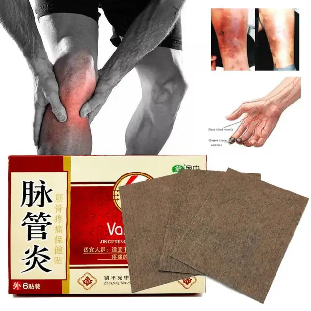 Chinese herbal medicine Patches Cure Spider Veins Varicose Treatment