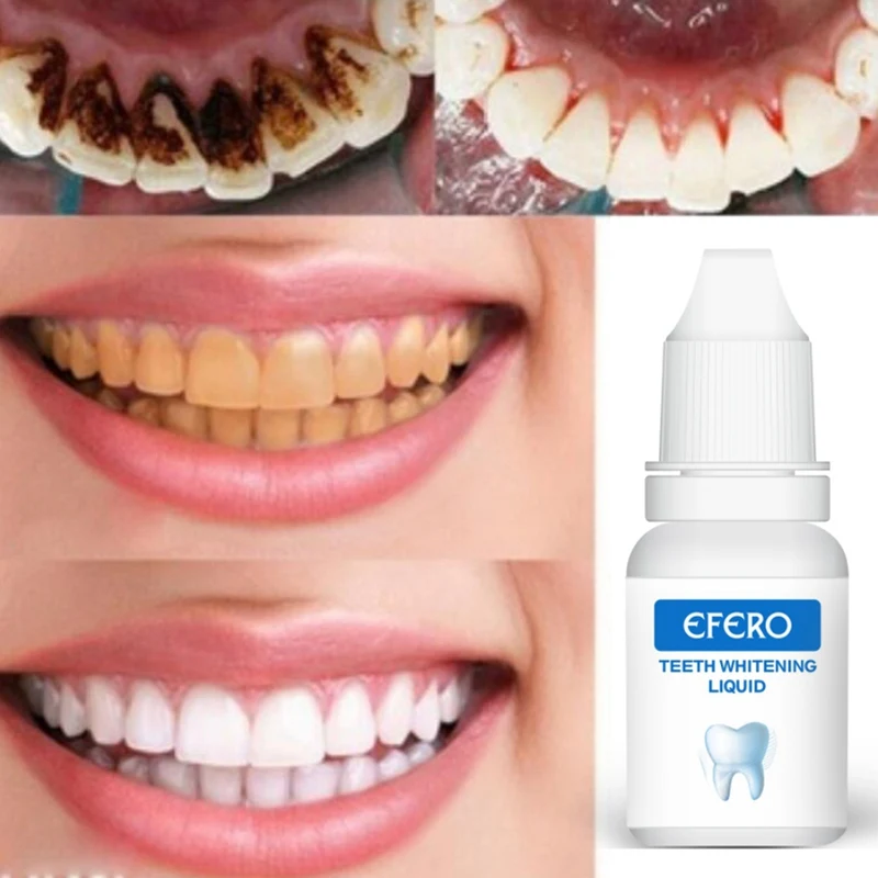 Гигиена полости рта Очищающая сыворотка удаляет пятна налета отбеливание зубов стоматологические инструменты зубная паста отбеливание