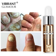 VIBRANTGLAMOUR Fungal Nail Treatment Feet Care Serum Nail Foot Nail Fungus Removal Gel Anti Infection Paronychia Onychomycosis