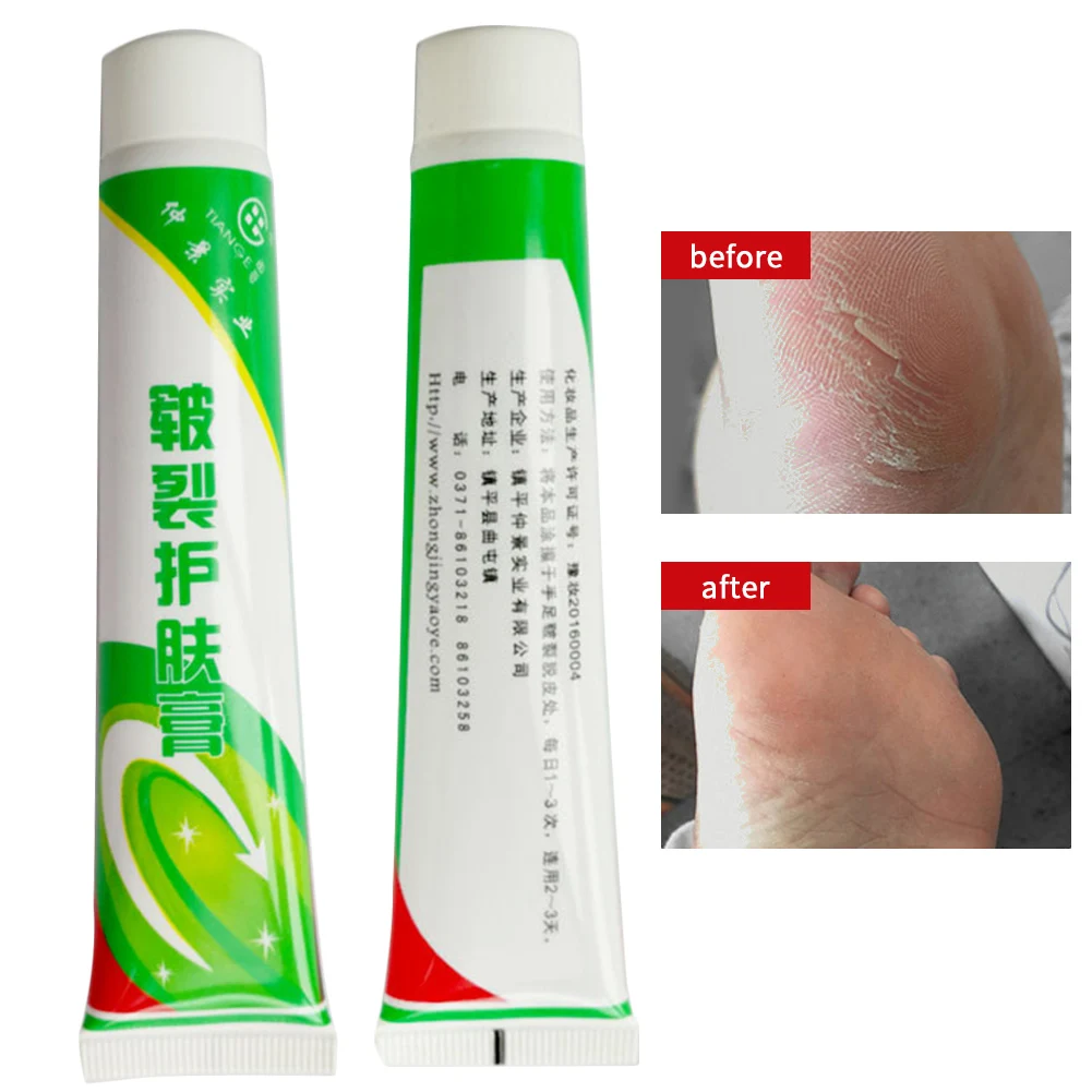 Нестареющий китайский лекарственный питательный крем для кожи рук от трещин на ногах Восстанавливающий Крем восстанавливающий крем 25 г мазь крем уход за кожей