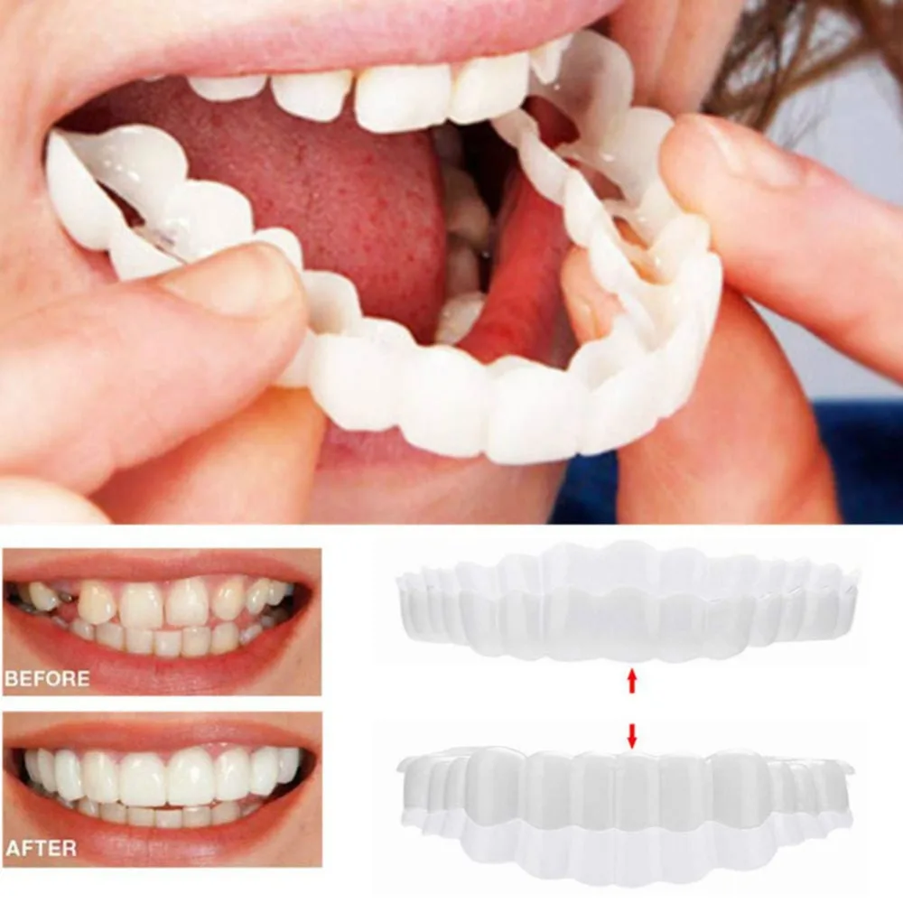 Dental Veneers Tooth Brace Removable Veneers Teeth ...