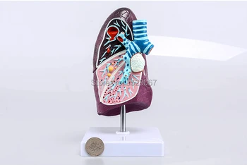 

Anatomical Diseased Lung Medical Model Pulmonary Reproductive system Anatomical anatomy abscess pneumonia tuberculosis cancer