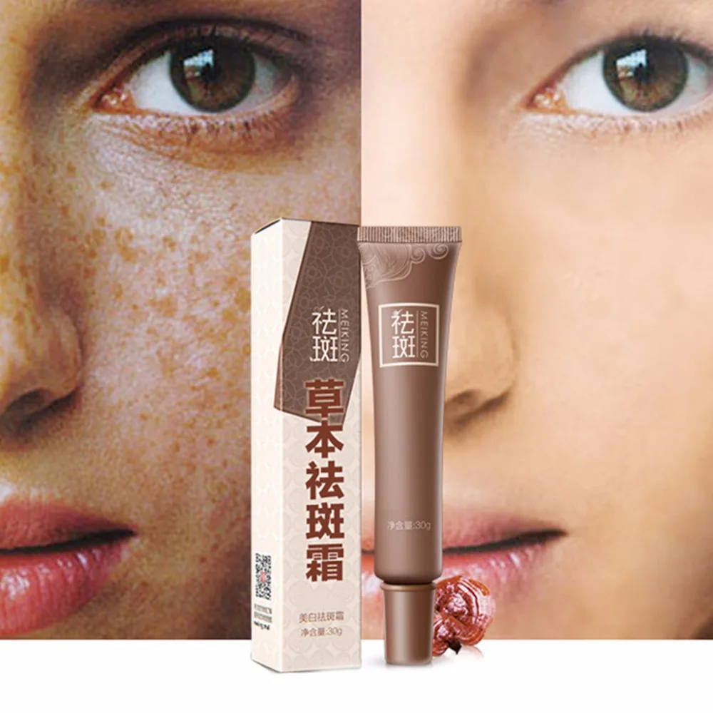 Skin Whitening Fade Blemish Removal Serum Spots Freckles Melasma