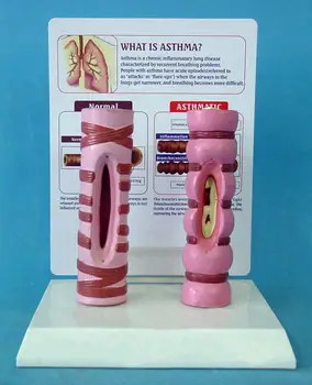 

Human Pathological Trachea Anatomy Model Human Tracheal Anatomy Model Sick Trachea Medical Teaching Model English Description