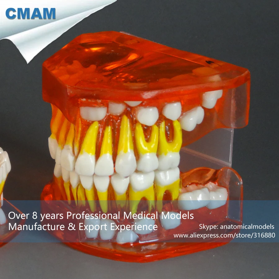 

CMAM-DT304 Removable Pink Silicone Gingiva Primary Dentition Development Study Model