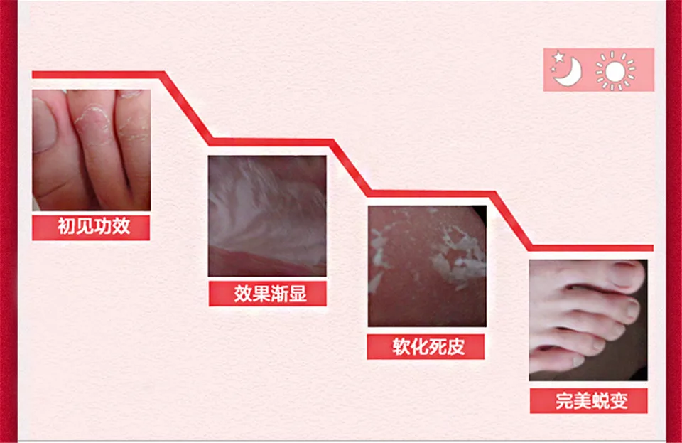 Пилинг для ног отшелушивающая маска для ног 5 пар/лот, чтобы раскрыть детскую ногу, чтобы удалить мозоли, роговые слои омертвевшей кожи