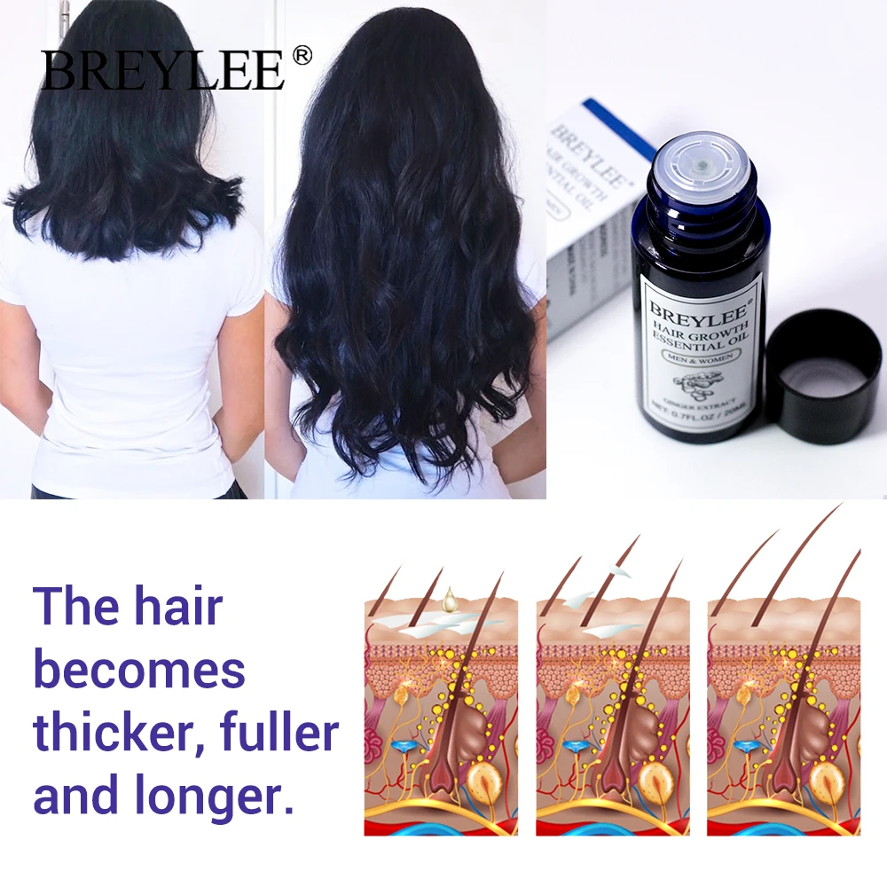 BREYLEE Hair Growth Essential Oil Fast Powerful Hair Products Hair Care Prevent Baldness Anti-Hair Loss Nourishing Serum Care