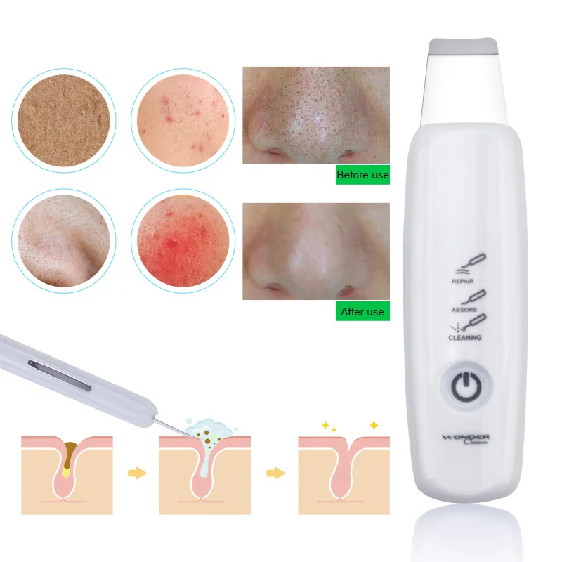 Ultrasonic Skin Scrubber Blackhead Removal Deep Face Cleaning Skin Peeling Extractor Skin Care Rejuvenation Beauty Device 4345