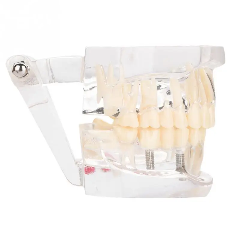 Новая Комплексная модель обучения стоматологии прозрачный нерв съемный молярный зуб