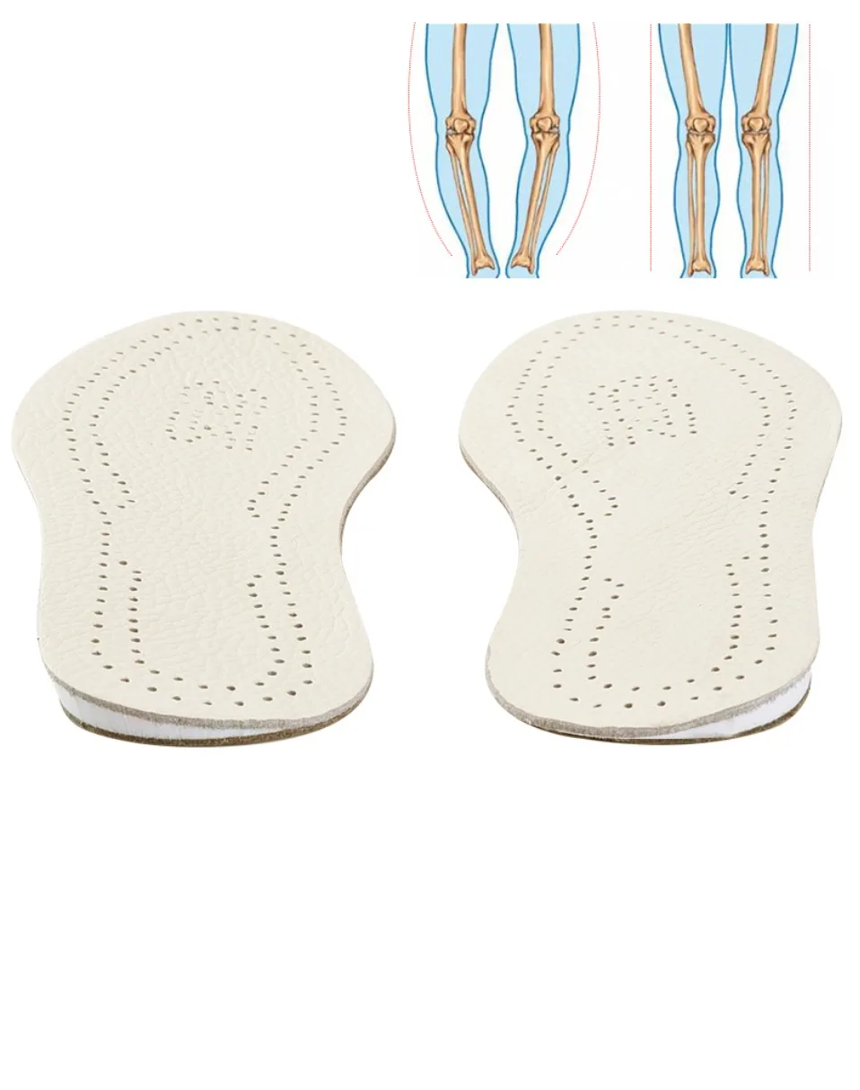 Soumit ортопедические стельки для обуви O/X Тип коррекции ног вставка колодки из воловьей кожи снаружи внутри обуви колодки для мужчин и женщин