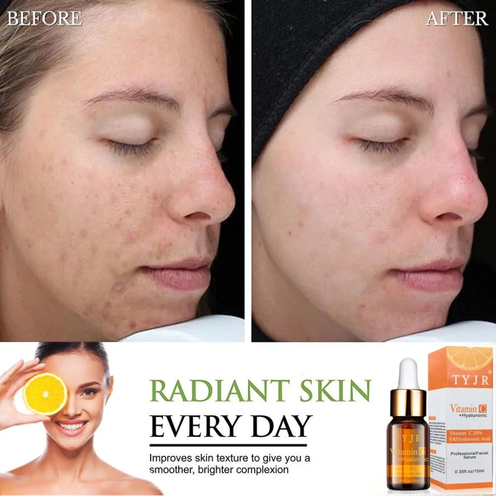Natural 20% Vitamin C Serum with Hyaluronic Acid Vitamin E Best Organic Anti Aging Anti Wrinkle Serum Moisturizer for Face Neck Natural 20% Vitamin C Serum with Hyaluronic Acid Vitamin E Best Organic Anti Aging Anti Wrinkle Serum Moisturizer for Face Neck