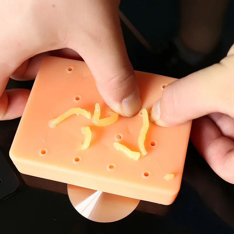 

Peach Pimple Popping Funny Popper Remover Stop Picking Your Face Squeeze Acne Stress Reliver Anti-stress Novelty Toy Children