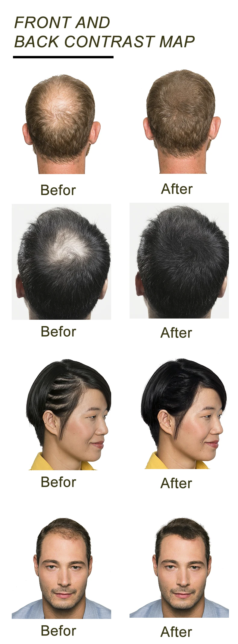 Мгновенное волокно для роста волос 28 г лечение выпадения волос органический загуститель кератин хлопок консилер облысение порошок строительные волокна 1 шт