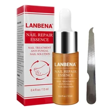 Против грибка Лечение грибка ногтей эссенция ремонт пальцев ног Уход за ногтями инфекция с пилкой для ногтей