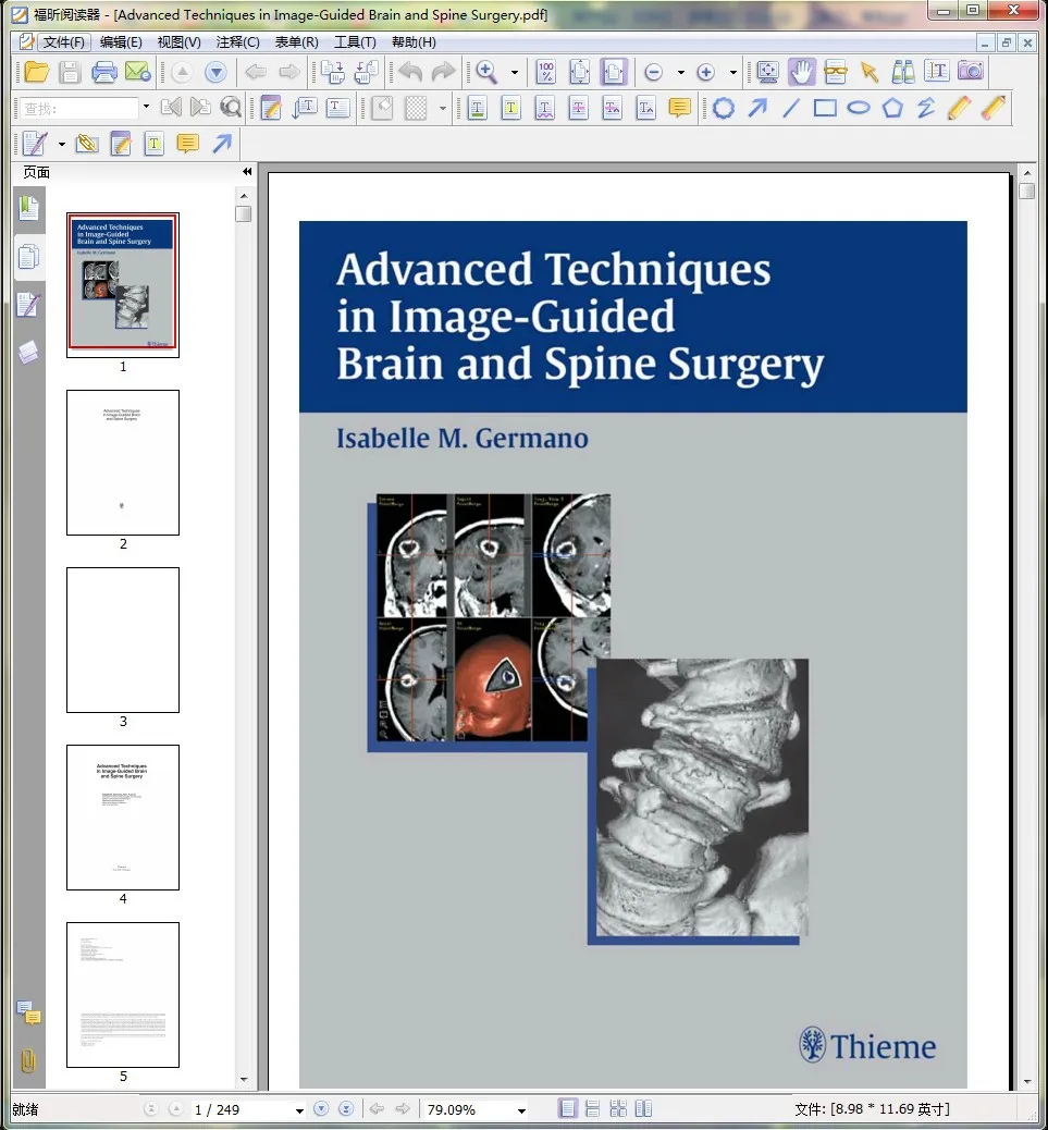 Advanced Techniques in Image-Guided Brain and Spine Surgery |