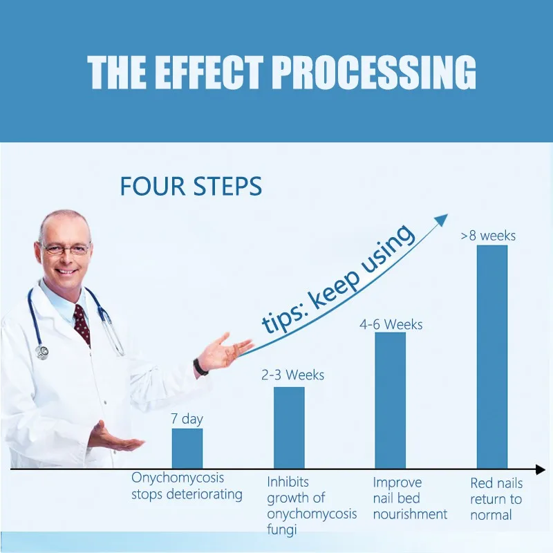 Хороший результат для лечения Ногтей ручка onychomicosis Paronychia против грибковой инфекции ногтей китайский травяной носок Лечение грибка ногтей
