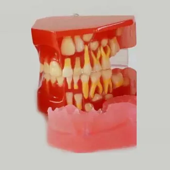 

Dental development 3-6 years old children's teeth development Model