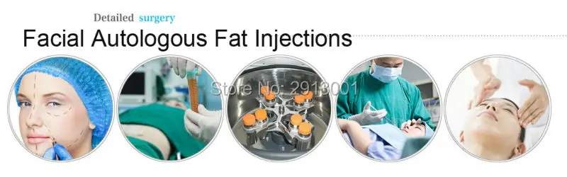 facial fat injection