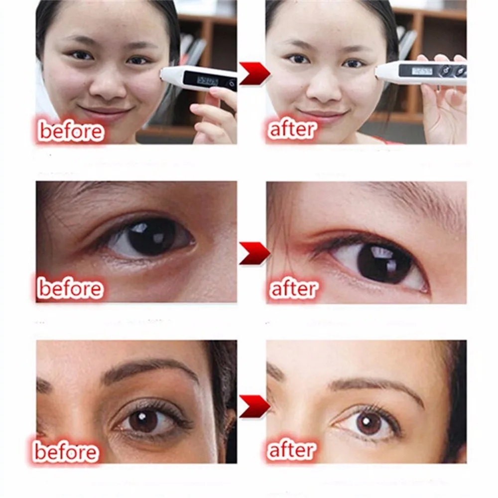 20g-Day-Night-Eye-Cream-Nursing-Elastic-Creams-Prevent-Moisturizing-Anti-Aging-Smooth-Repair-Dry-Skin (2)