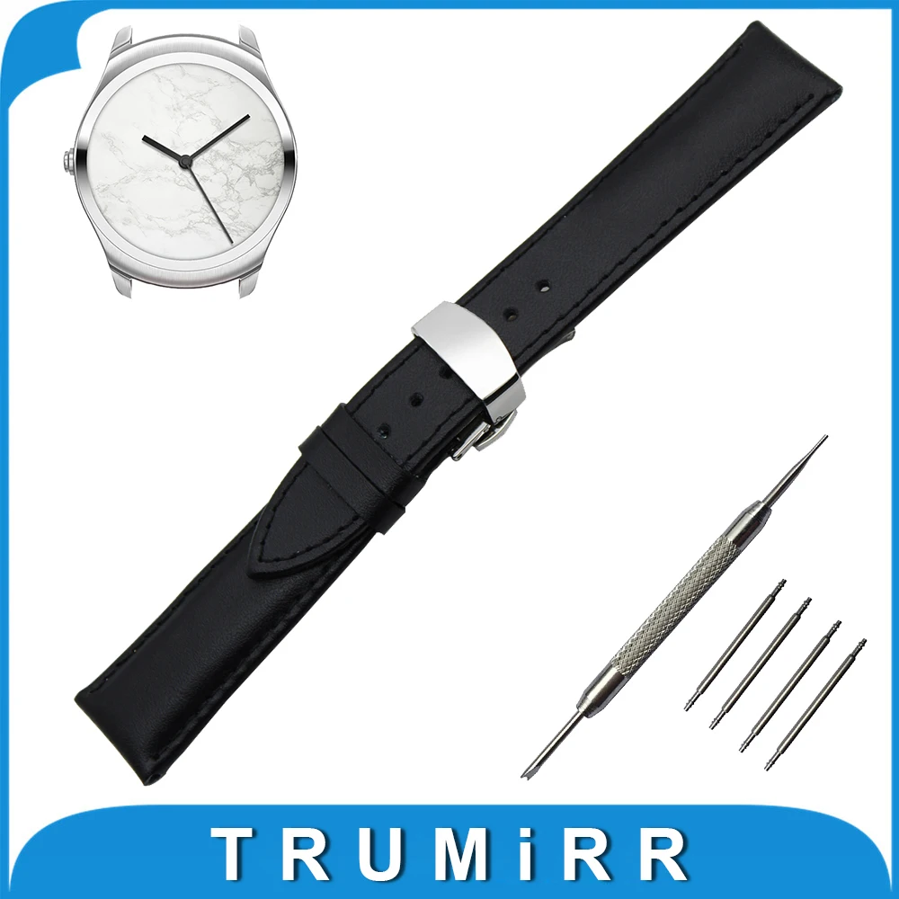 tic band watch