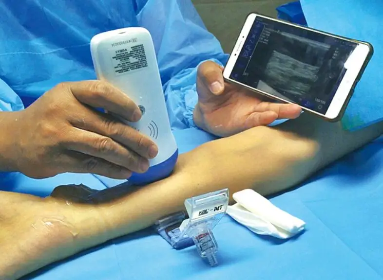 Wireless Probe Type Ultrasound Scanner (6)