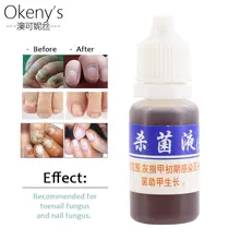 Лекарственная формула травяное средство для восстановления ногтей жидкий светильник пудра «ARMOR Essence» питательное масло для ногтей питательное масло для кутикулы ногтей смягчающее средство