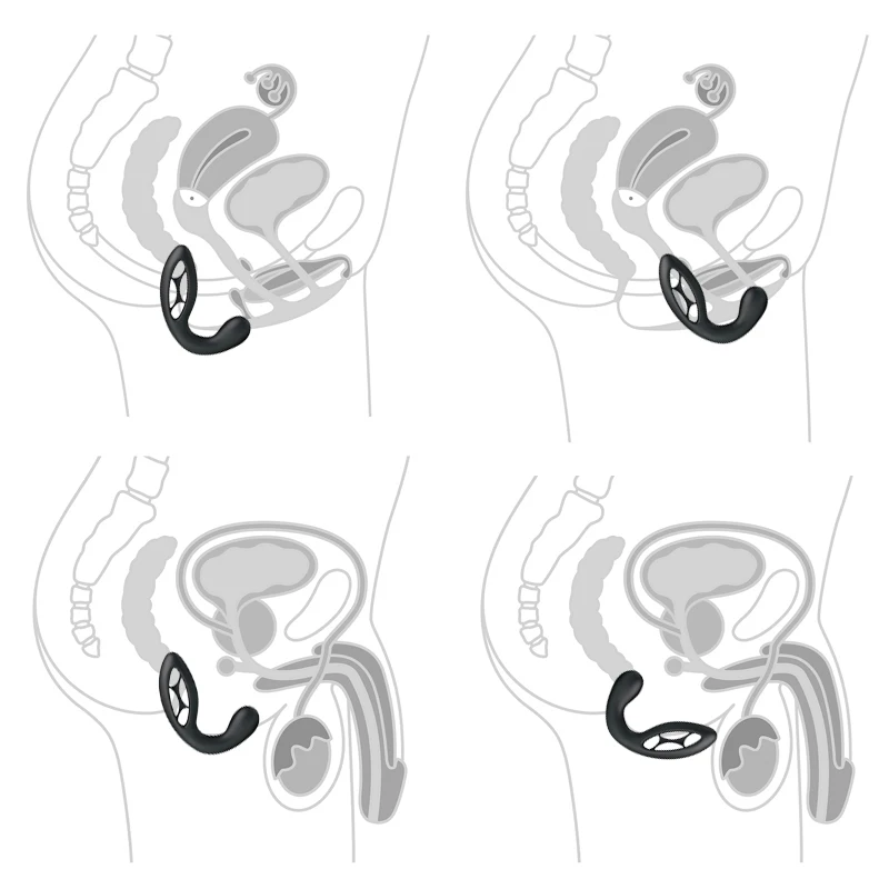 Prostate stimulation
