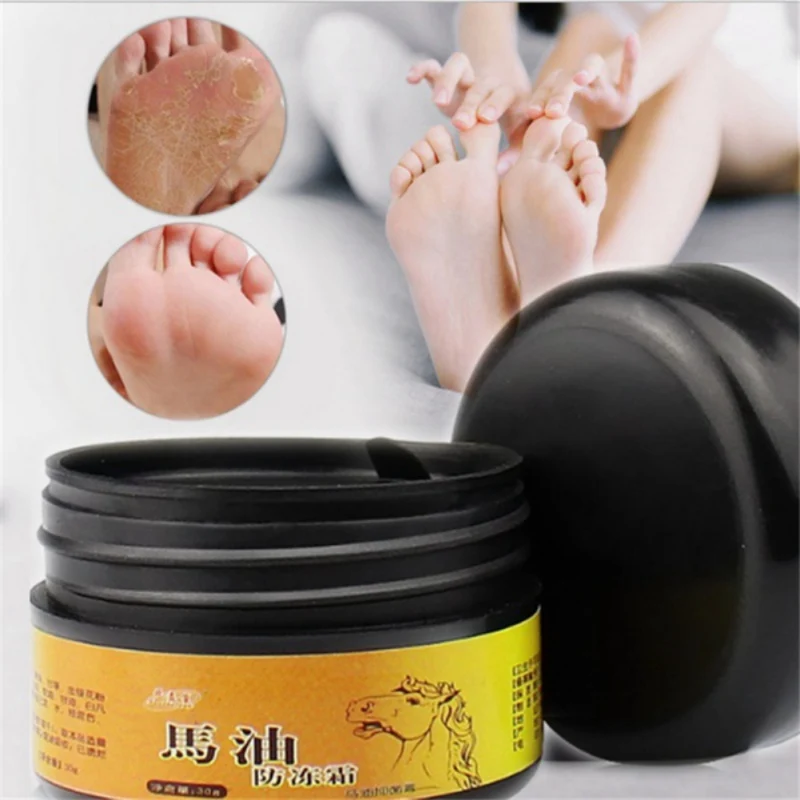 Horse Oil Foot Hand Antifreeze Cream Treatment Dry Skin Heel Chapped Peeling Repair Beauty Skin Care Products