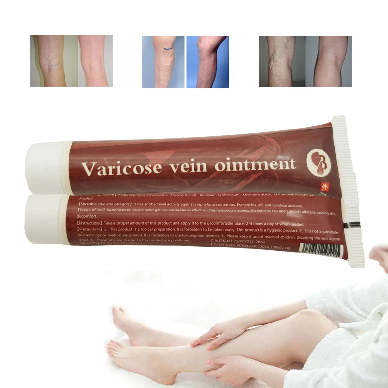 

3pcVaricose Veins Treatment Cream Effective cure Vasculitis Phlebitis Spider Veins Pain Varicosity Angiitis ointment Health Care