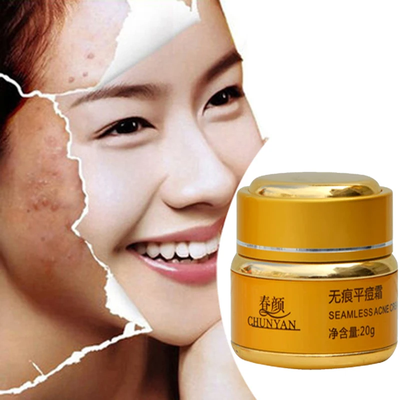 pigmentation removal ointment