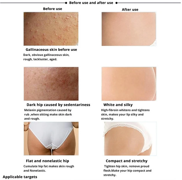 100 Natural Hip Lift Up Cream Fast Bigger Lady Butt Plump Ass