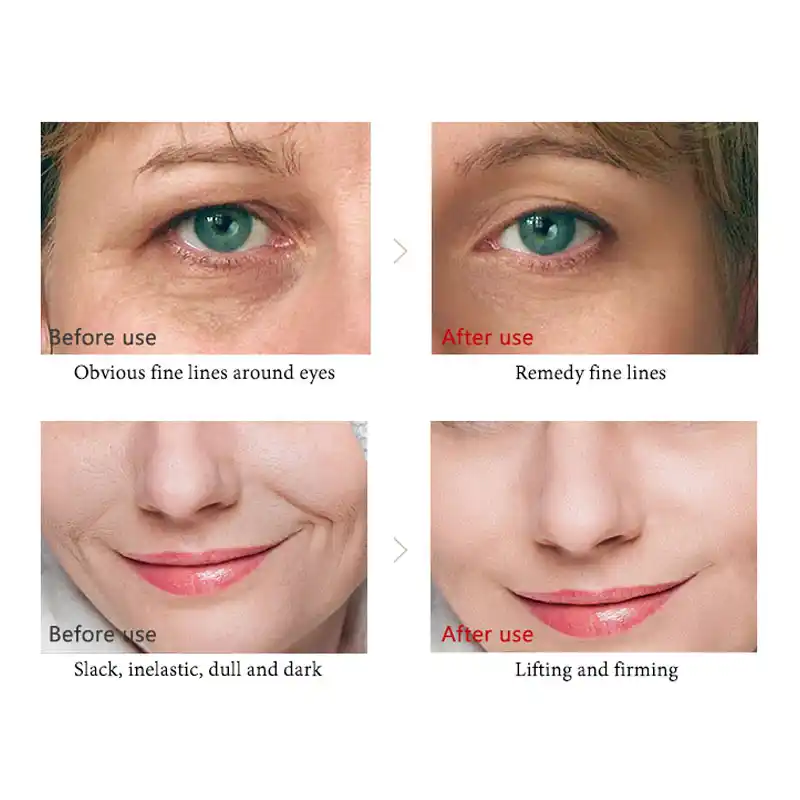 vitamin c serum under eyes